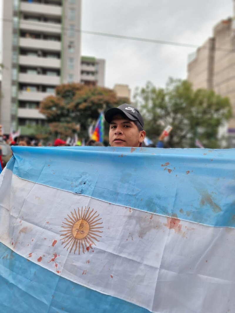 Argentina's flag spotted with blood. Source: Telam Argentina